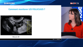 Monitorage de l'ovulation pour une prise en charge optimale