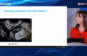 Monitorage de l'ovulation pour une prise en charge optimale