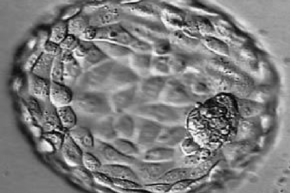 Actualités sur le blastocyste | Revue Vision