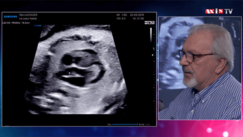 Examen fetal 2025