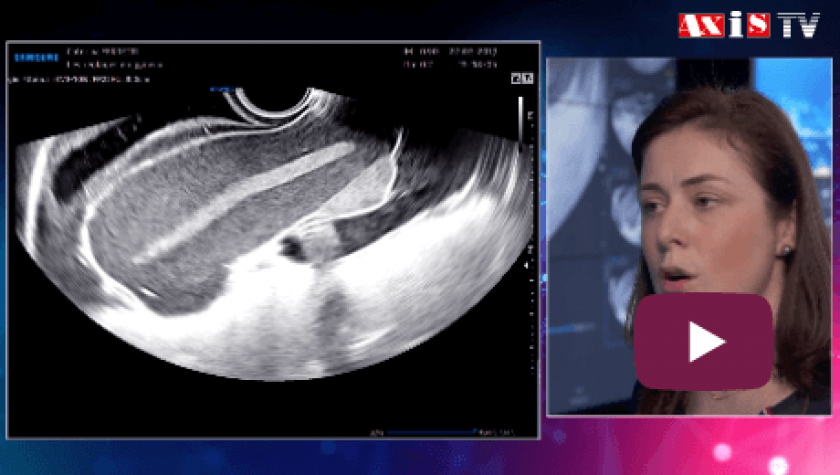 Échographie pelvienne : démonstration | Revue Vision